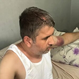 dayi tutuklandi miras kavgasi buyudu m7w4xDAW