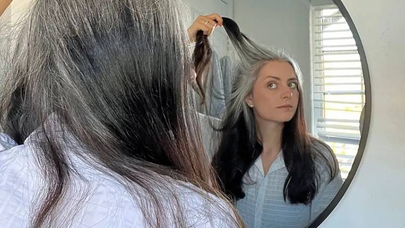 sacin erken beyazlamasinin nedenleri neler eski saclari geri getirmek mumkun mu 92BSuule.jpg